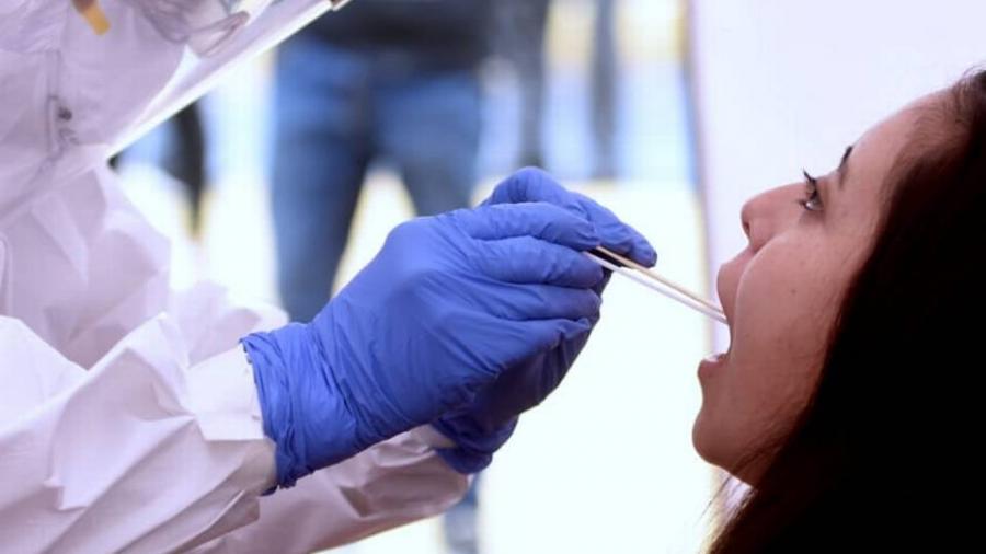 Italia producirá prueba COVID por saliva que da resultado en tres minutos