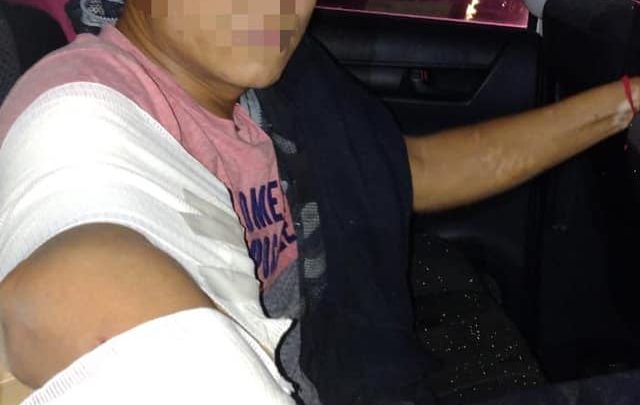 Por la lesión que presentó, ameritó ser trasladado a uno de los nosocomios de la ciudad.