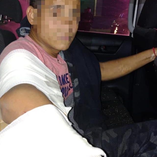 Por la lesión que presentó, ameritó ser trasladado a uno de los nosocomios de la ciudad.