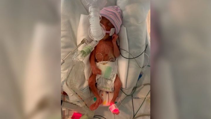 El Libro Guinness de Récords coronó a Curtis Means como el bebé más prematuro en el mundo: “Comenzó a escribir su propia historia el día que nació”