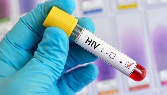 La vacuna busca estimular la producción de anticuerpos capaces de actuar ante distintas variantes del VIH