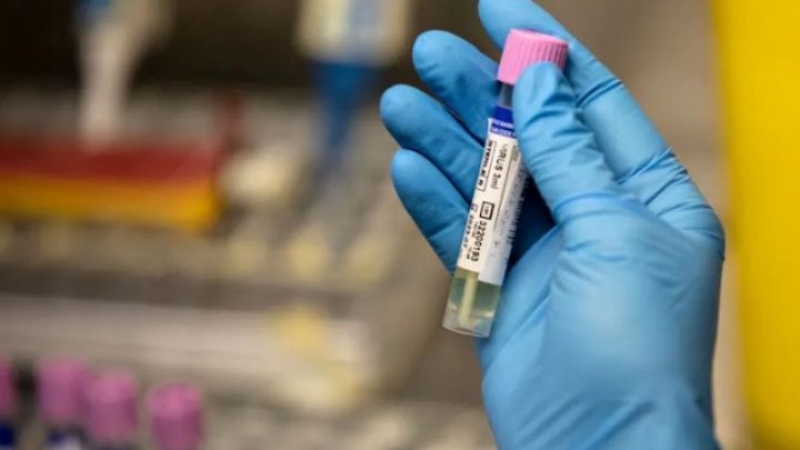 ¡De todo! Detectan viruela del mono, COVID y VIH en paciente italiano