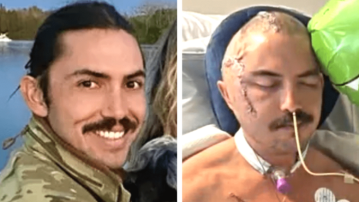 Hombre sobrevive tras ser atacado por un caimán en Florida