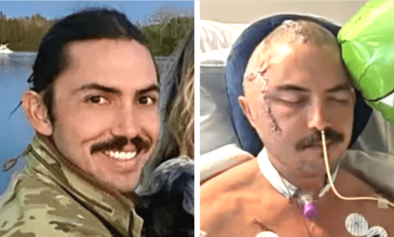 Hombre sobrevive tras ser atacado por un caimán en Florida