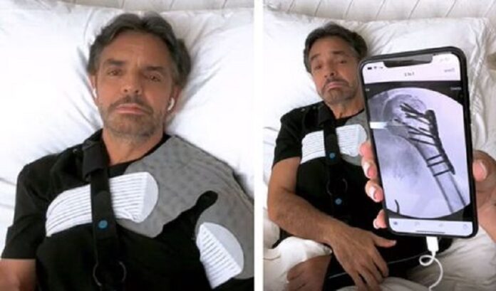 Eugenio Derbez reaparece y explica todo sobre su accidente (VIDEO)