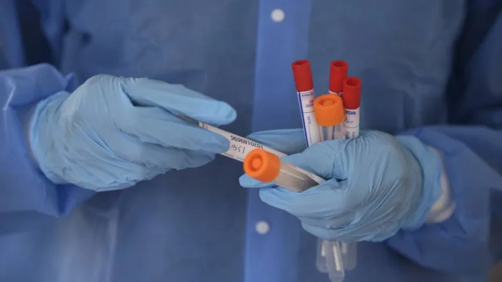 ¿Qué sabemos de “El Kraken”, la nueva variante del COVID?