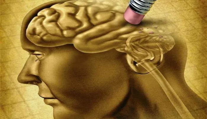 Expertos informan sobre probable primer caso de paciente de 19 años con Alzheimer