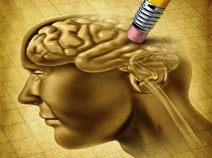 Expertos informan sobre probable primer caso de paciente de 19 años con Alzheimer