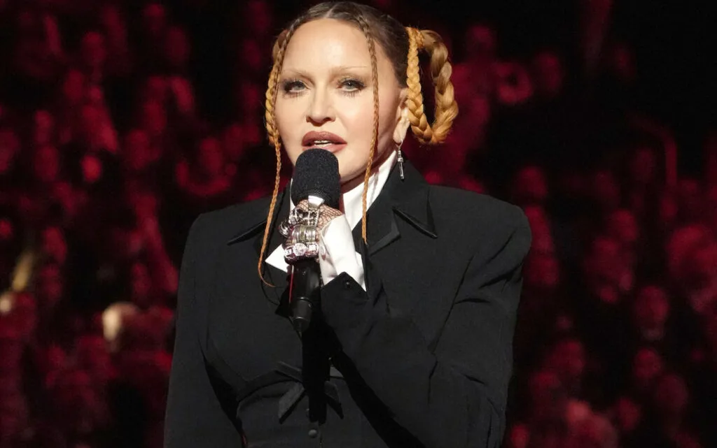 Madonna habla de su cirugía: recibe elogios y críticas