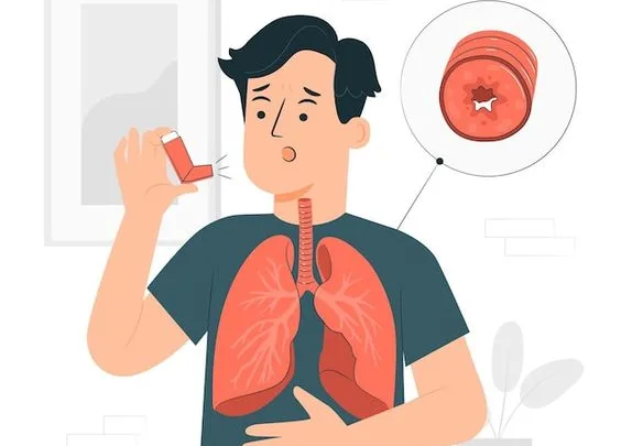 Hasta 73% de las personas con asma no están diagnosticadas de forma adecuada