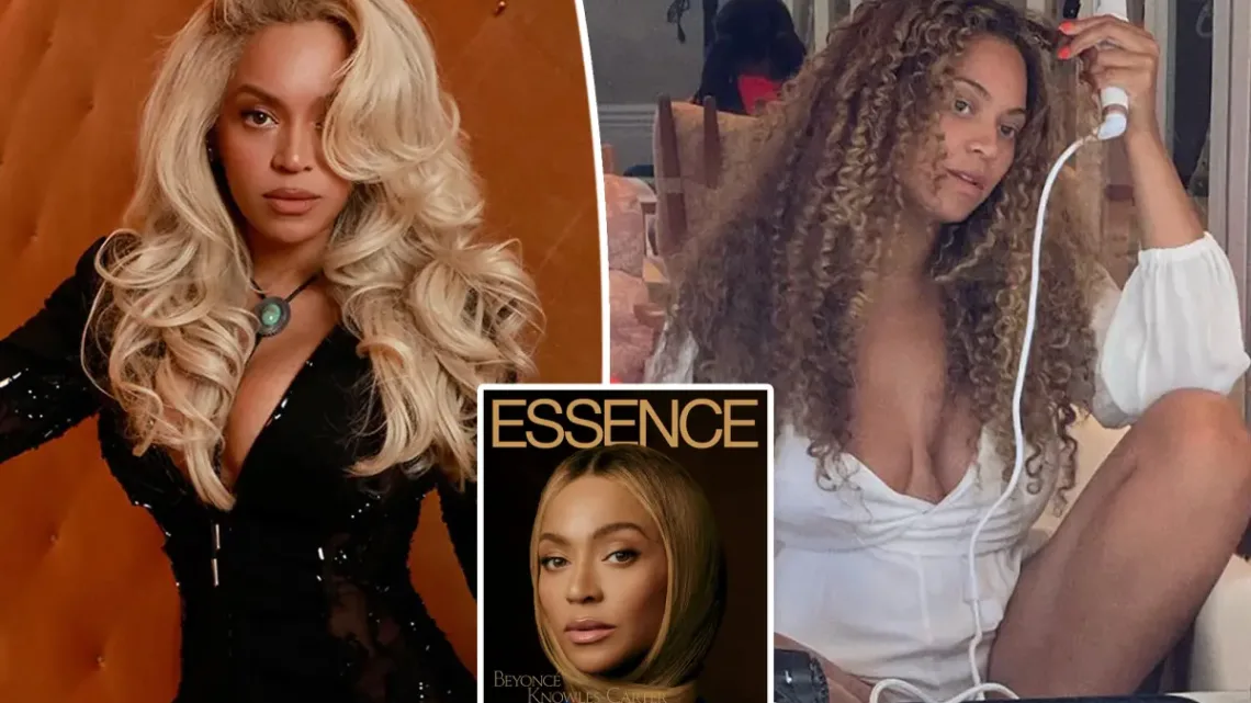 Beyoncé Revela su Batalla contra la Psoriasis: Comparte su Viaje Personal con la Enfermedad