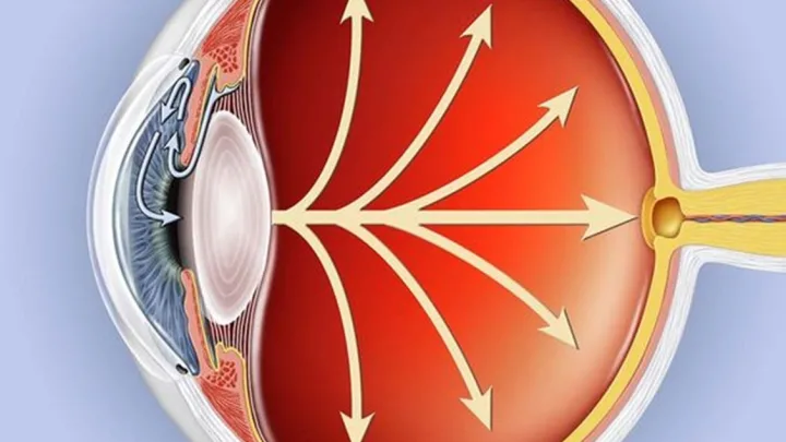La Secretaría de Salud conmemora el Día Nacional del Glaucoma