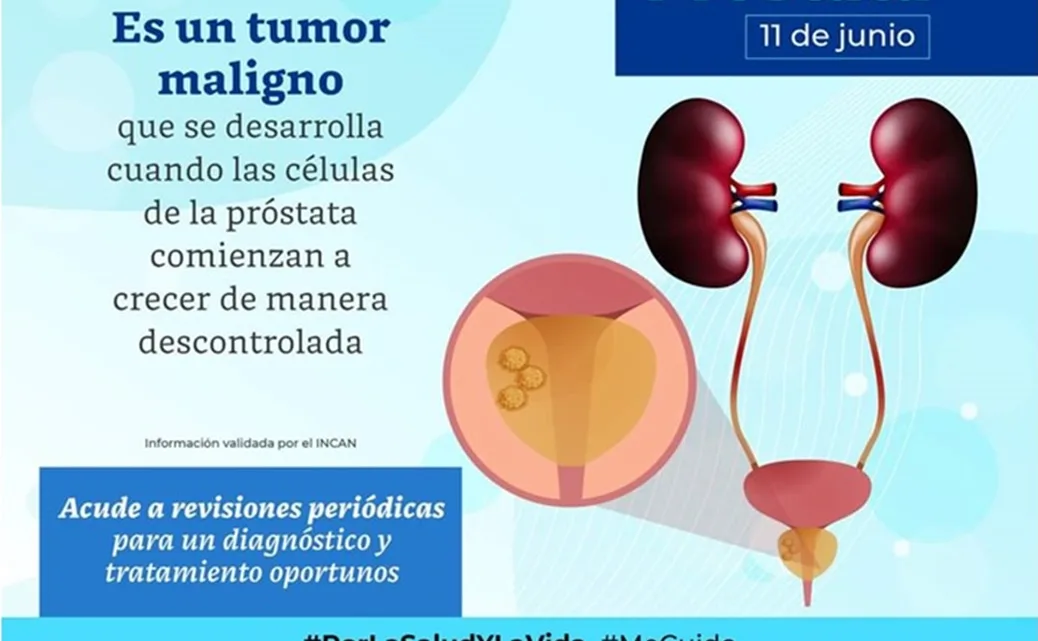 Se suma SESA a la conmemoración del Día Mundial del Cáncer de Próstata
