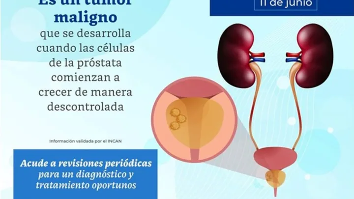 Se suma SESA a la conmemoración del Día Mundial del Cáncer de Próstata