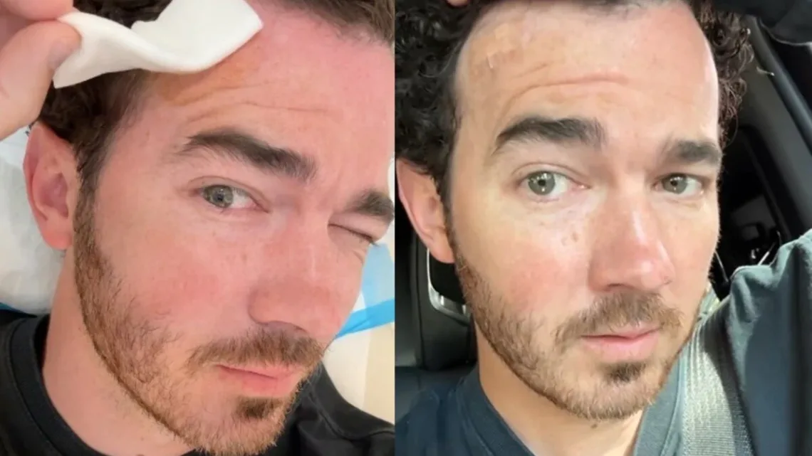 Kevin Jonas revela que fue operado por un cáncer de piel