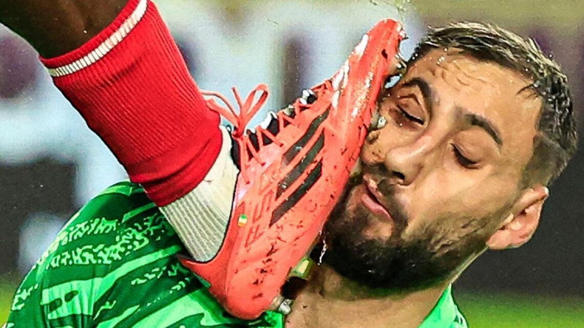 Donnarumma sufre grave lesión facial tras choque con Singo