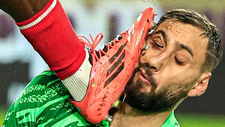 Donnarumma sufre grave lesión facial tras choque con Singo