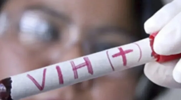Según datos del Repavih, se ha registrado un cambio epidemiológico pues la mayoría de los casos detectados son en personas menores de 30 años
