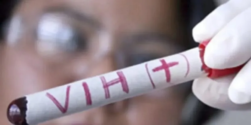 Según datos del Repavih, se ha registrado un cambio epidemiológico pues la mayoría de los casos detectados son en personas menores de 30 años