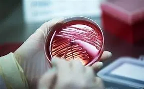 Tedros Adhanom Ghebreyesus, director general de la OMS, indicó este viernes que la hipótesis de que el virus de la COVID-19 se originara por una fuga en un laboratorio, sigue sin descartarse