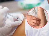 El Comité Nacional para la Vigilancia Epidemiológica emitió un aviso epidemiológico, para promover que el personal de salud a detecte y notifique los casos de sarampión