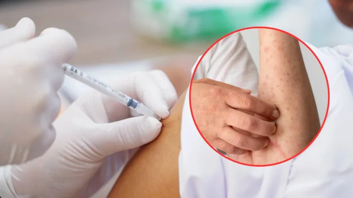 El Comité Nacional para la Vigilancia Epidemiológica emitió un aviso epidemiológico, para promover que el personal de salud a detecte y notifique los casos de sarampión