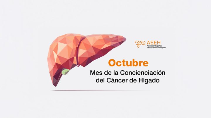Se suma SESA a la conmemoración del Día Mundial del Cáncer de Hígado